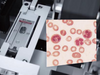 Blood-Smear Microscope Slides